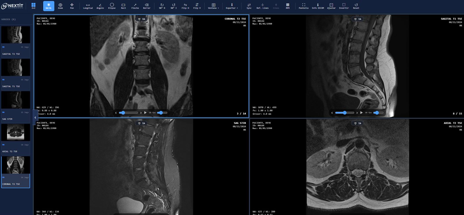 Visor DICOM de NextIT: layout 2x2 con cuatro series