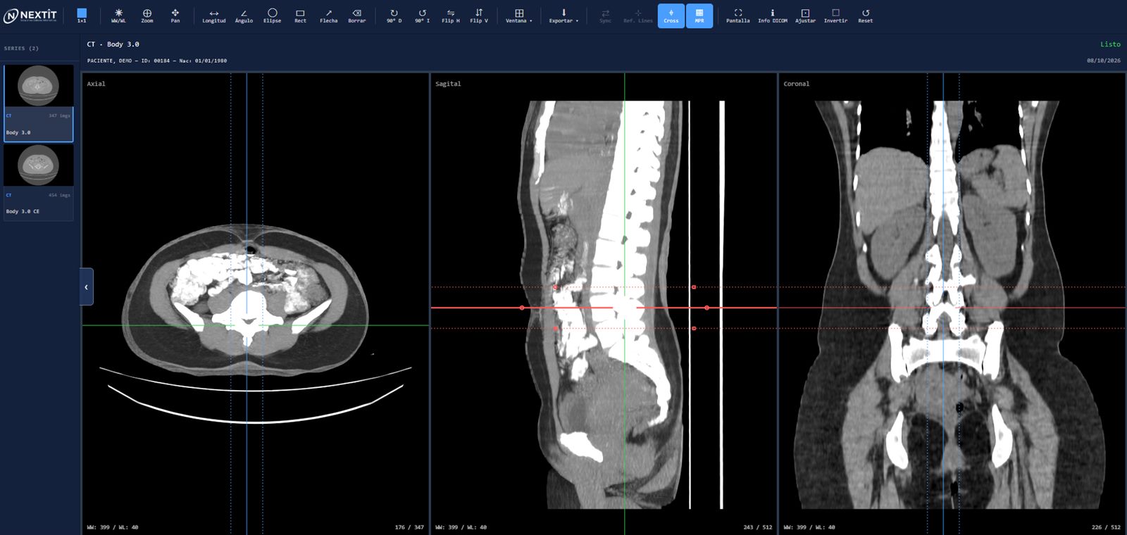 Visor DICOM de NextIT: reconstrucción multiplanar axial, sagital y coronal